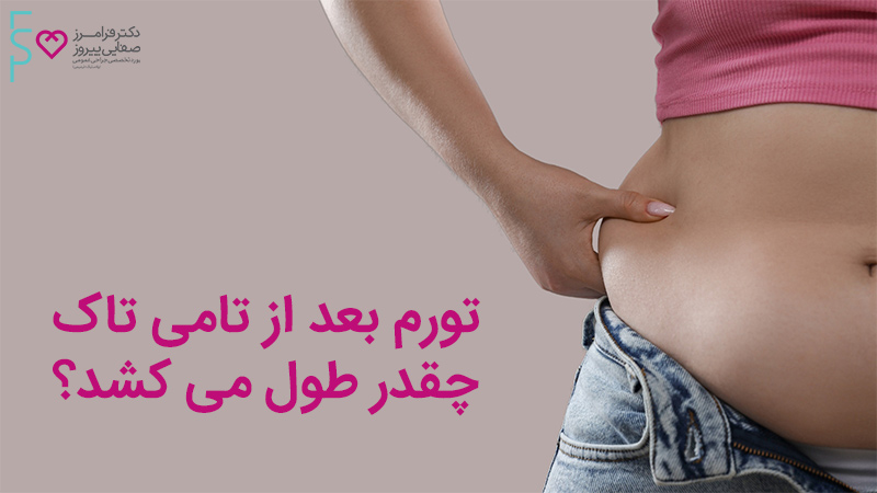 تورم بعد از تامی تاک چقدر طول می کشد؟